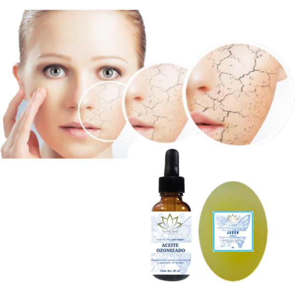 Aceite Y Jabón Ozonizado Para Heridas Acné Regenera La Piel - Imagen 6